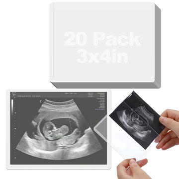 Easy Insert Photo Protector for 3x4in Ultrasound Pictures - Side-Loading to Keep Baby Sonogram Picture/Special Memories Safe, Pregnancy Journal Must Haves, Pregnancy Gifts for Expecting Mom, 20 Pack