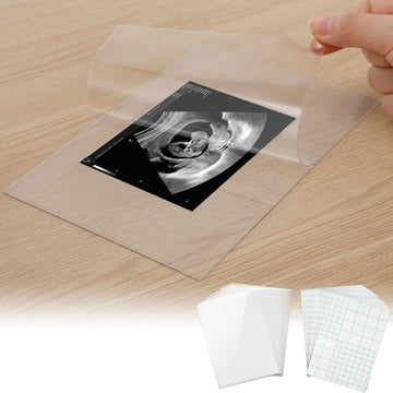 20 Sets User-Friendly Laminating Sheets for 3x4/4x6in Ultrasound Pictures- Keep Baby Sonogram Picture/Special Memories Safe, Pregnancy Journal Must Haves, Pregnancy Gifts for Expecting Mom